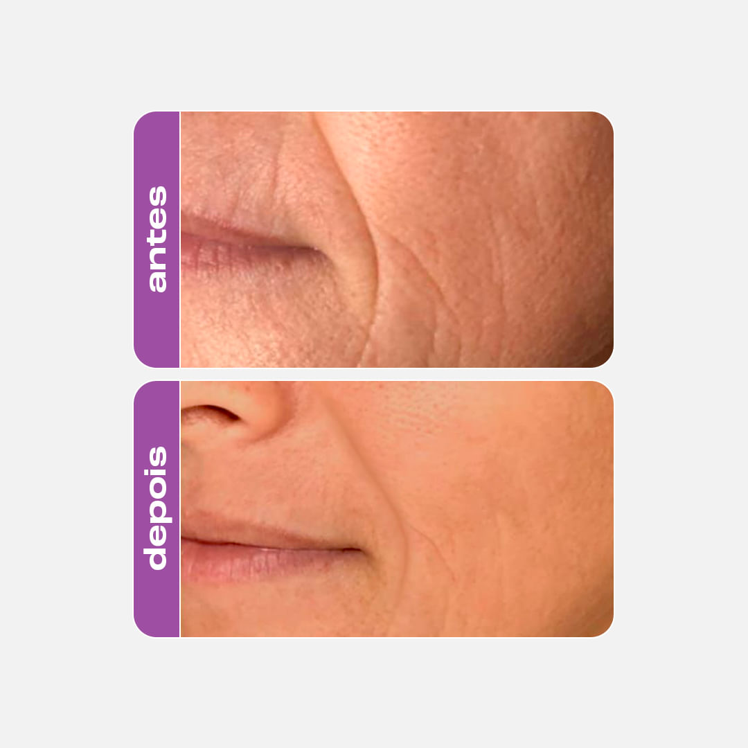 Mini Retinol